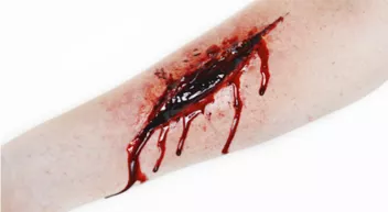 Dans quelle situation utiliser un garrot? Last Guide