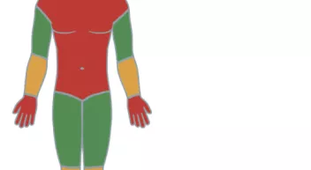 Où poser un garrot? Last Guide