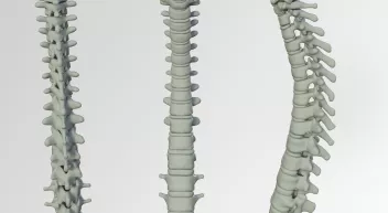 Comment réagir à une blessure à la colonne vertébrale selon la Wilderness Medicine? Last Guide