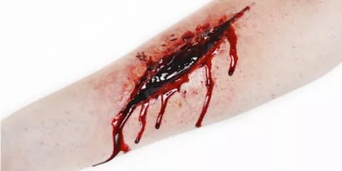 Dans quelle situation utiliser un garrot? Last Guide