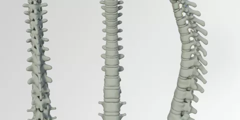 Comment réagir à une blessure à la colonne vertébrale selon la Wilderness Medicine? Last Guide