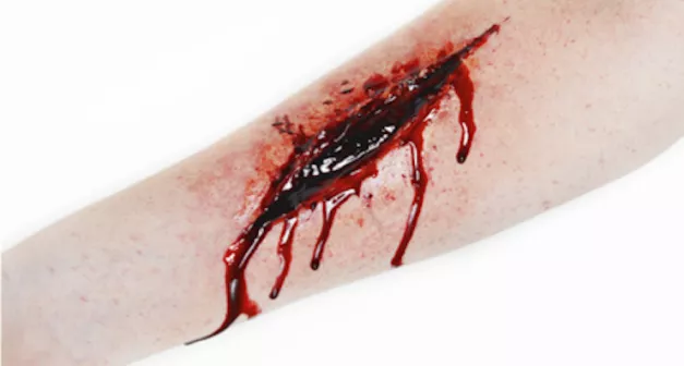 Dans quelle situation utiliser un garrot? Last Guide