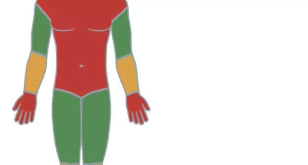 Où poser un garrot? Last Guide