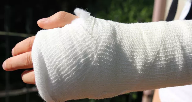 Comment réagir à une fracture ou entorse selon la Wilderness Medicine? Last Guide