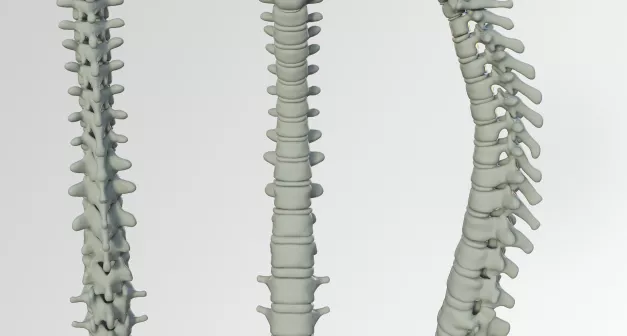 Comment réagir à une blessure à la colonne vertébrale selon la Wilderness Medicine? Last Guide