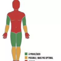 Où poser un garrot? Last Guide